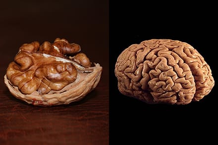 walnut and brain